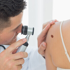 Skin Cancer Screenings